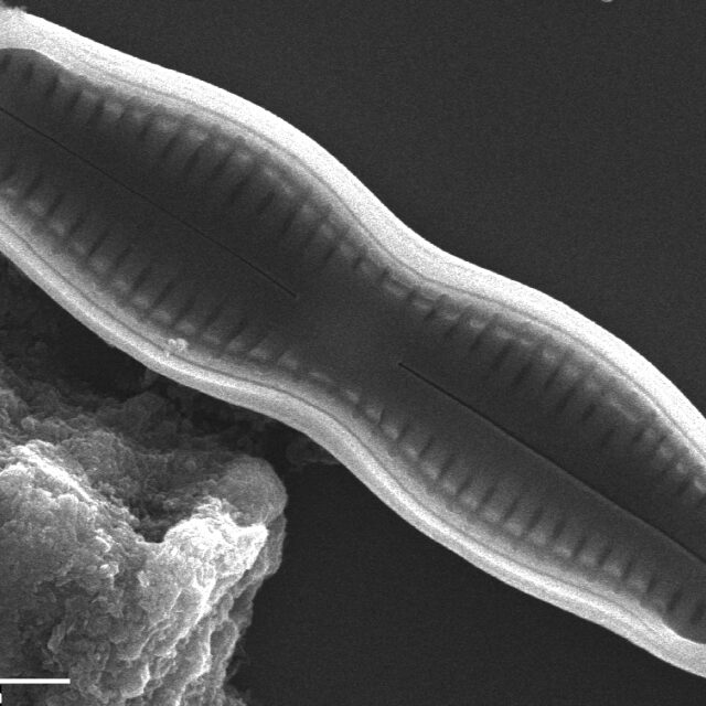 Humidophila undulata SEM2