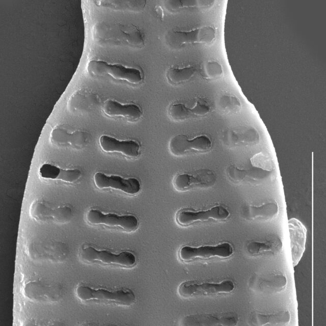 Karayevia nitidiformis SEM1