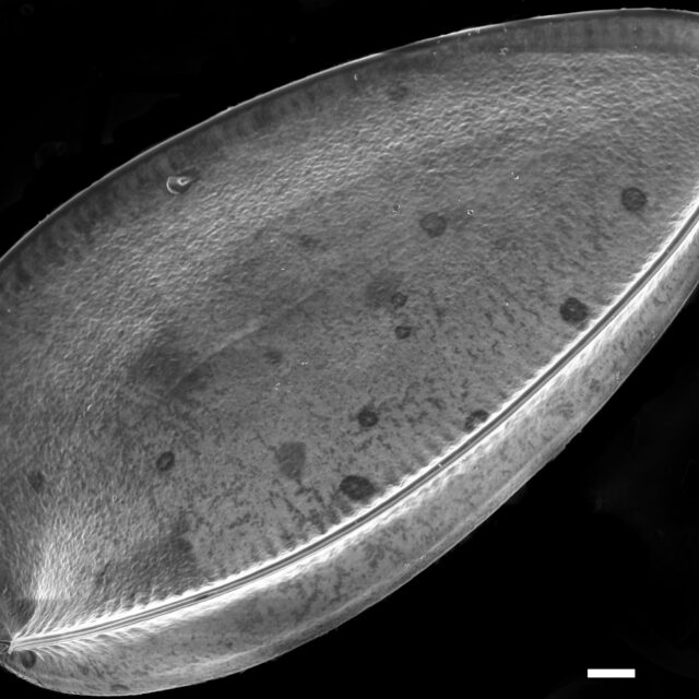 Iconella guatimalensis SEM1