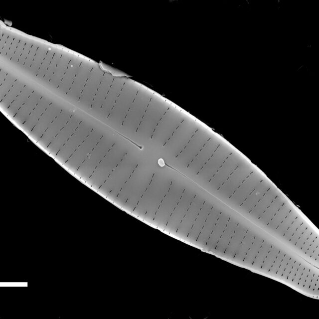 Achnanthidium druartii SEM3