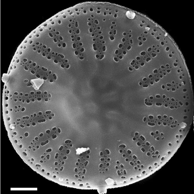 Discostella lakuskarluki SEM1