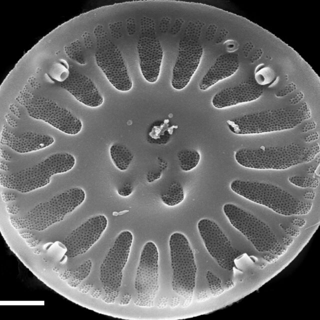 Discostella lakuskarluki SEM3