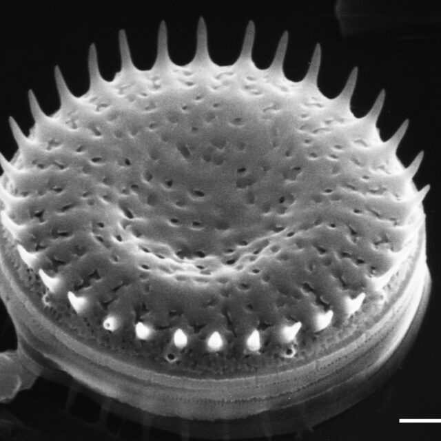 Stephanodiscus minutulus SEM1