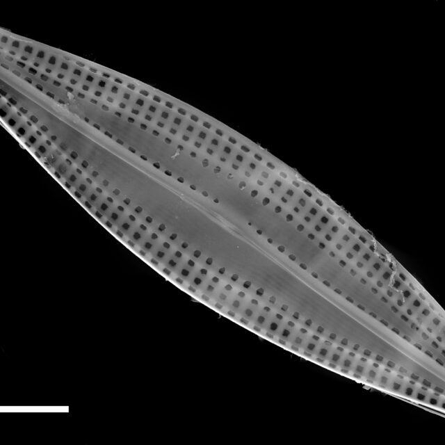 Biremis circumtexta SEM1