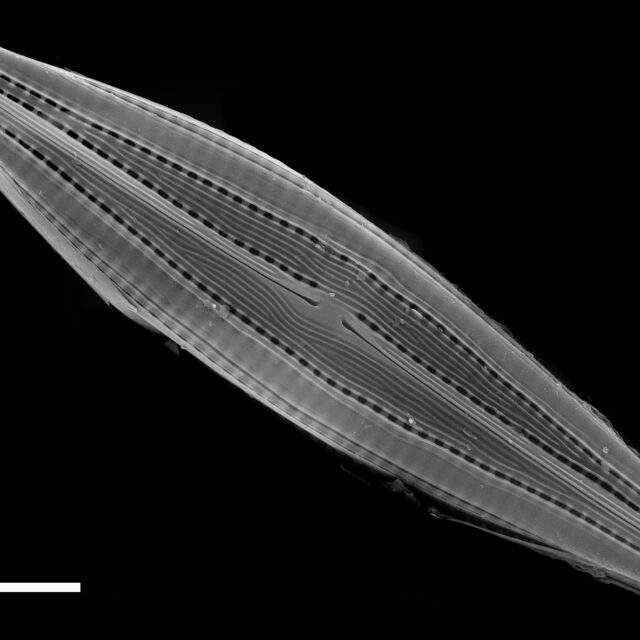 Biremis circumtexta SEM2