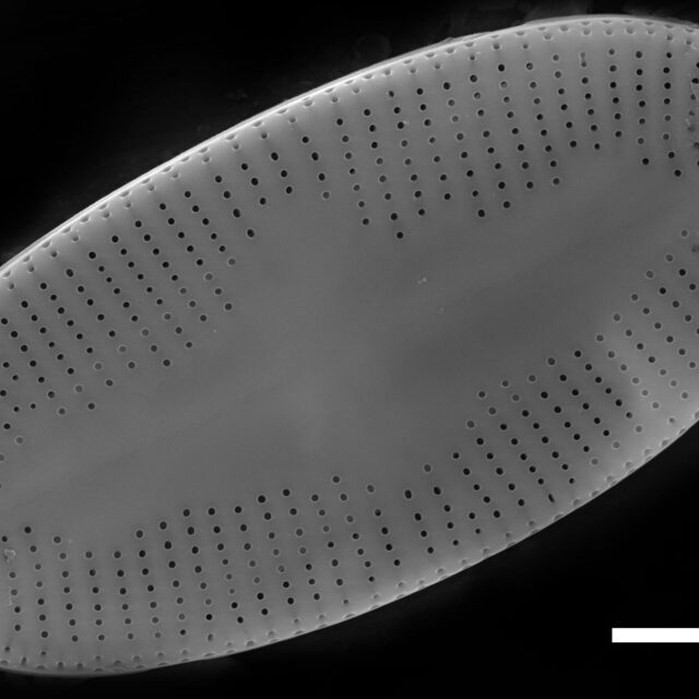 Psammothidium daonense SEM1