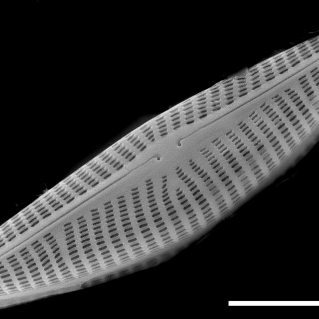 Navicymbula pusilla SEM1