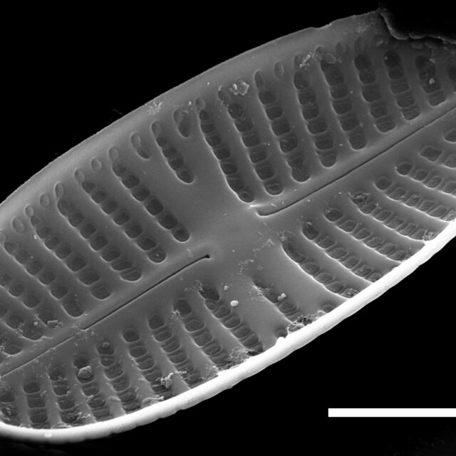 Psammothidium curtissimum SEM1