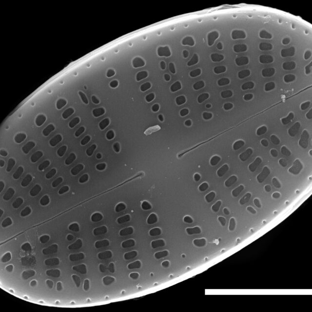 Psammothidium curtissimum SEM2