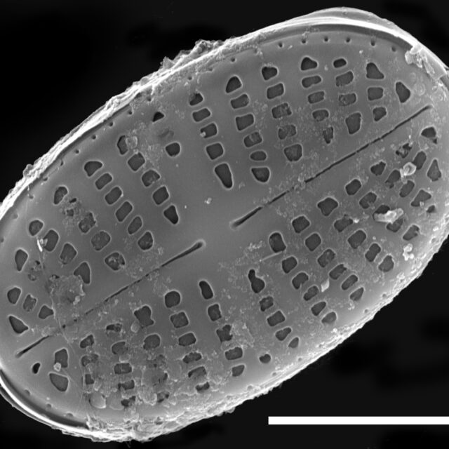 Psammothidium curtissimum SEM3