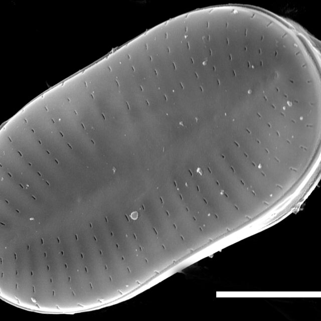 Psammothidium didymum SEM1