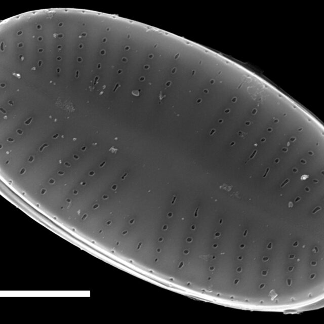 Psammothidium curtissimum SEM4