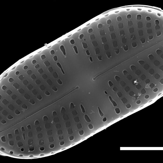 Psammothidium didymum SEM3