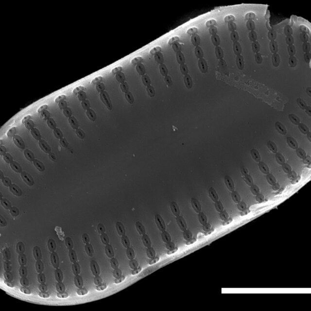 Psammothidium didymum SEM5