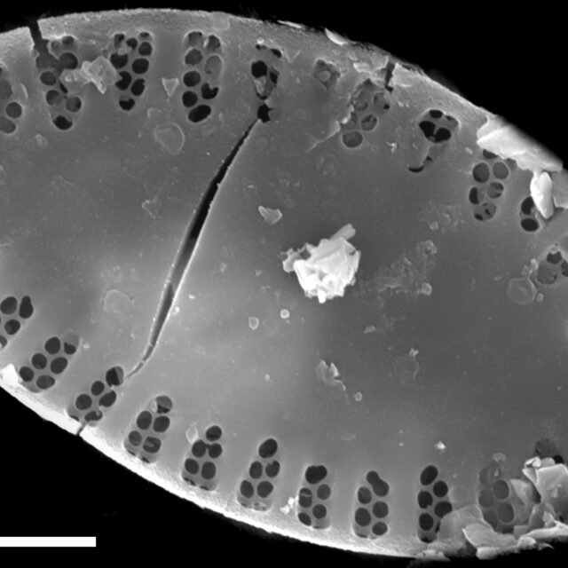 Platessa lutheri SEM1