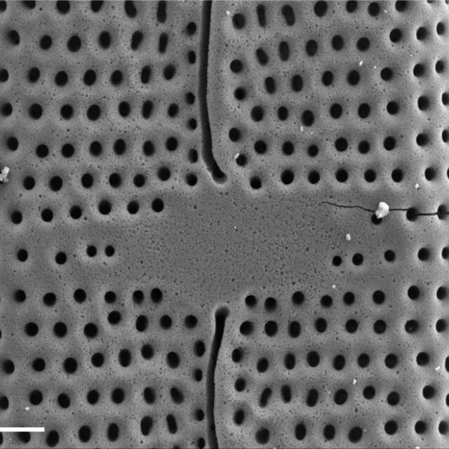 Mastogloia calcarea SEM1