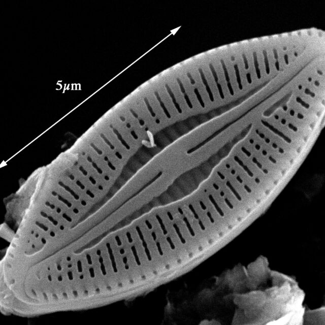 Microcostatus krasskei SEM1