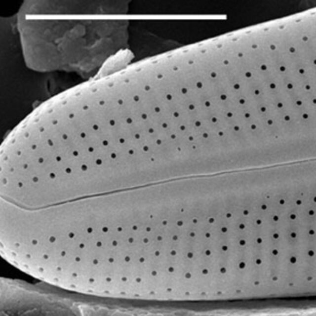 Muelleria gibbula SEM1