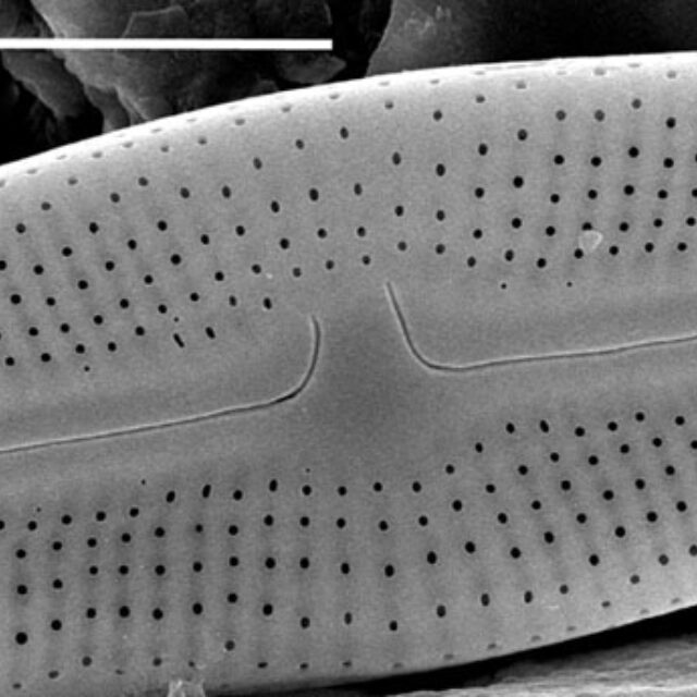 Muelleria gibbula SEM2