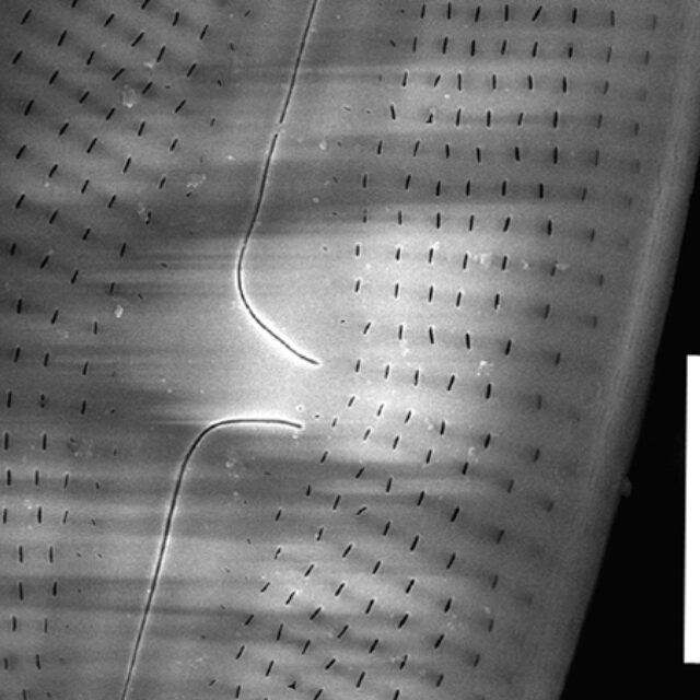 Muelleria spauldingiae SEM1