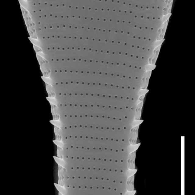 Actinella punctata SEM1