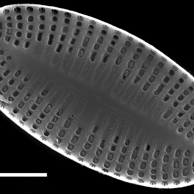 Psammothidium levanderi SEM2