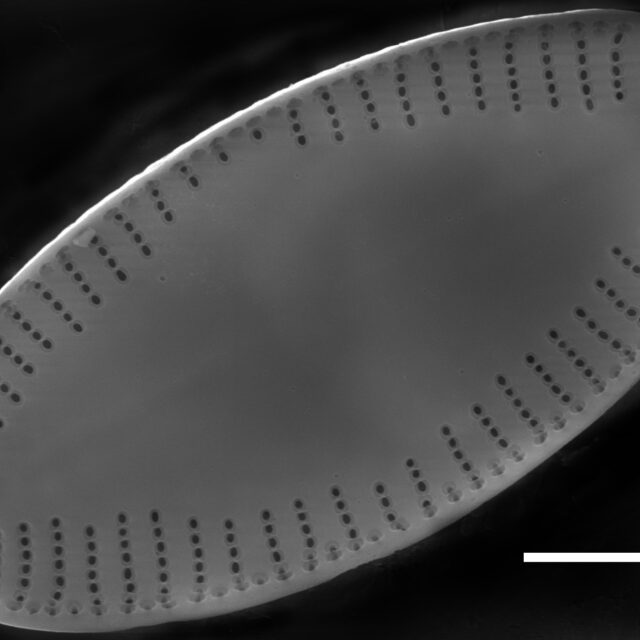 Psammothidium acidoclinatum SEM1