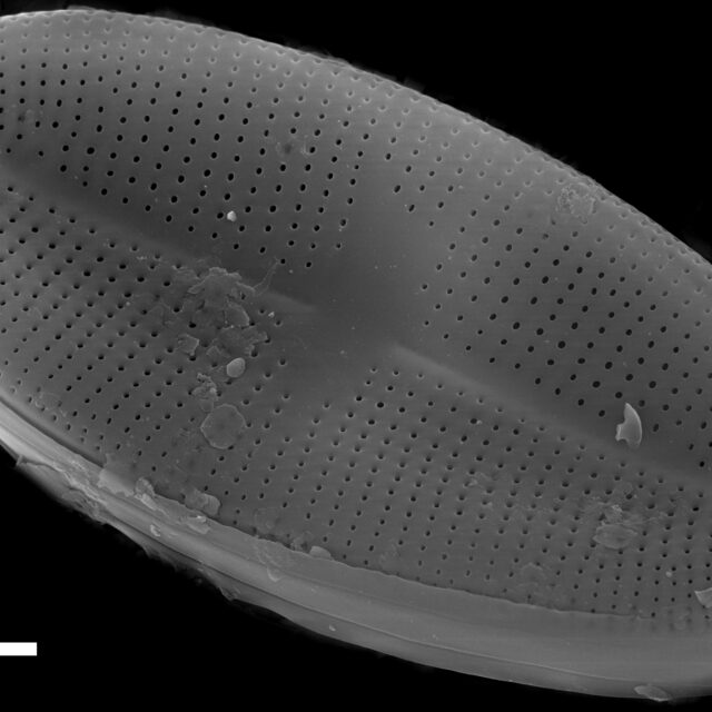 Psammothidium bioretii SEM1