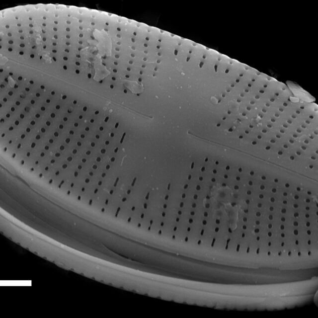 Psammothidium daonense SEM2