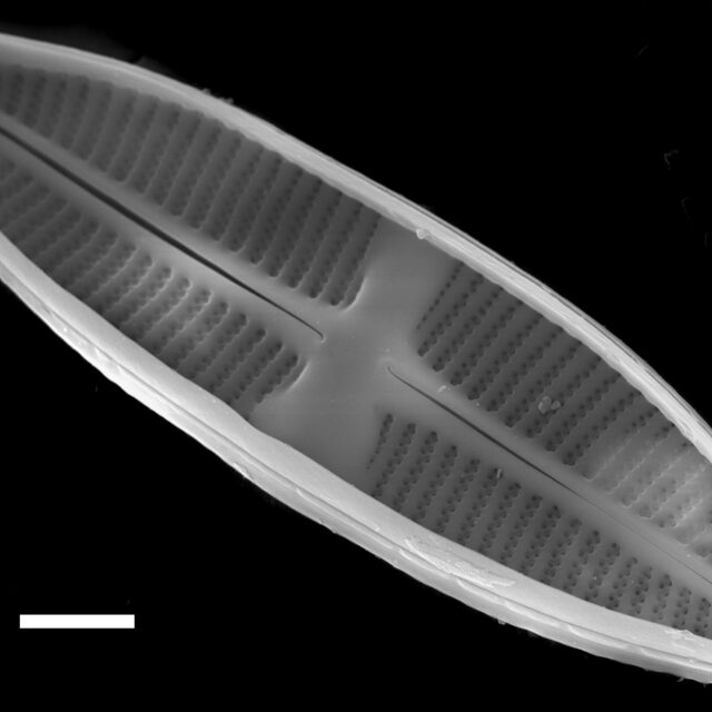 Lemnicola hungarica SEM1