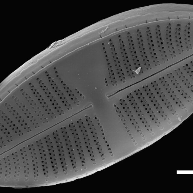 Lemnicola hungarica SEM3