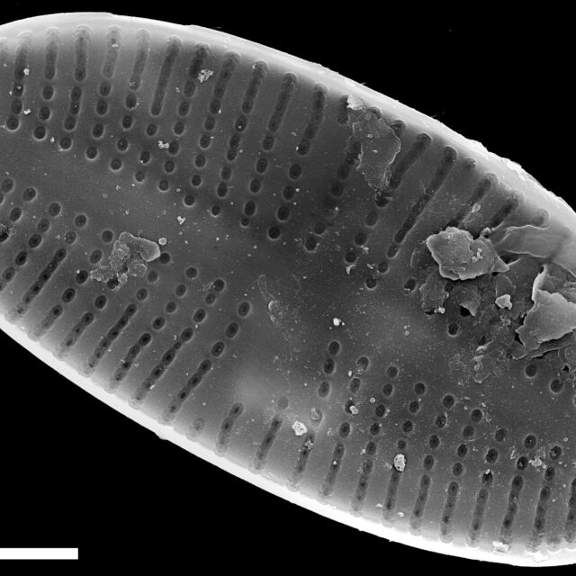 Psammothidium pennsylvanicum SEM1