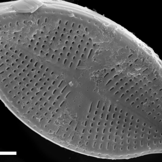 Psammothidium harveyi SEM3