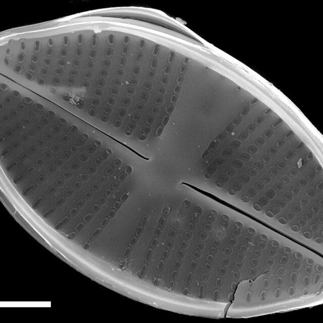 Psammothidium harveyi SEM4