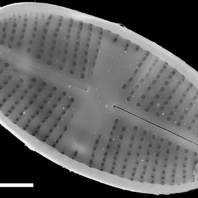 Psammothidium pennsylvanicum SEM4