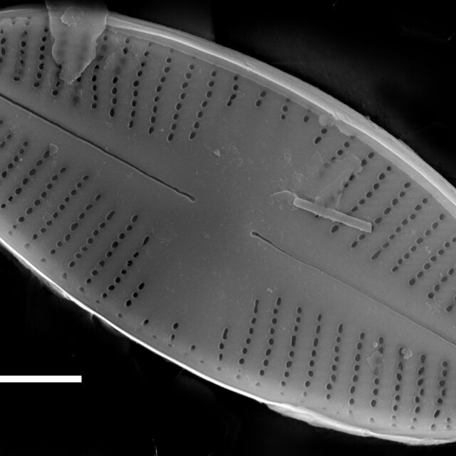 Psammothidium acidoclinatum SEM2