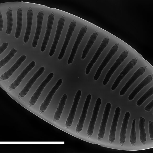 Platessa stewartii SEM1