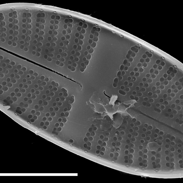 Platessa stewartii SEM2