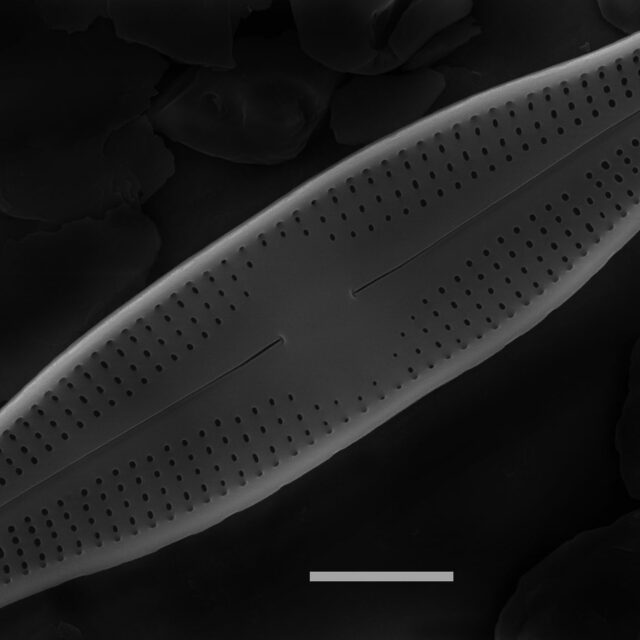 Nupela elegantula SEM1