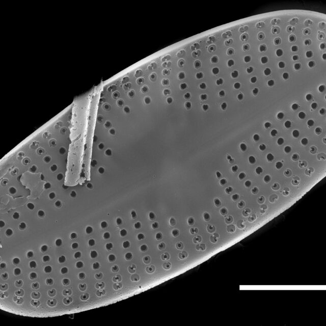 Psammothidium scoticum SEM1