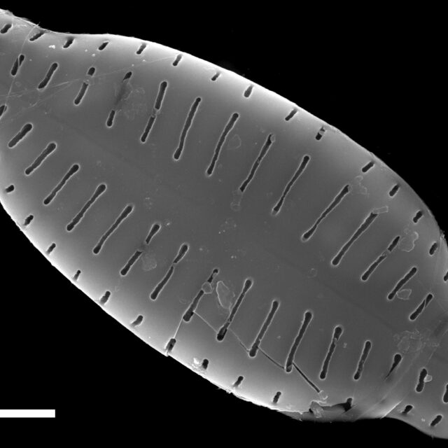 Karayevia ploenensis var gessneri SEM1