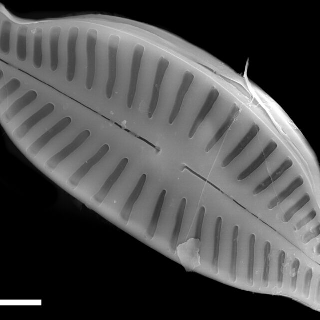 Karayevia ploenensis var gessneri SEM2