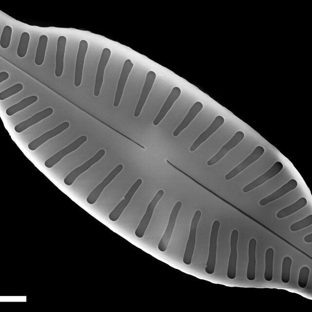 Karayevia ploenensis var gessneri SEM3