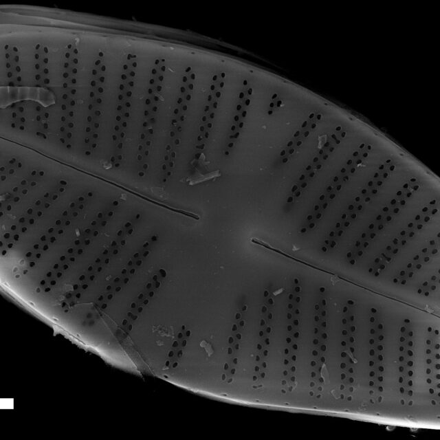 Platessa strelnikovae SEM1