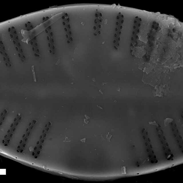 Platessa strelnikovae SEM2