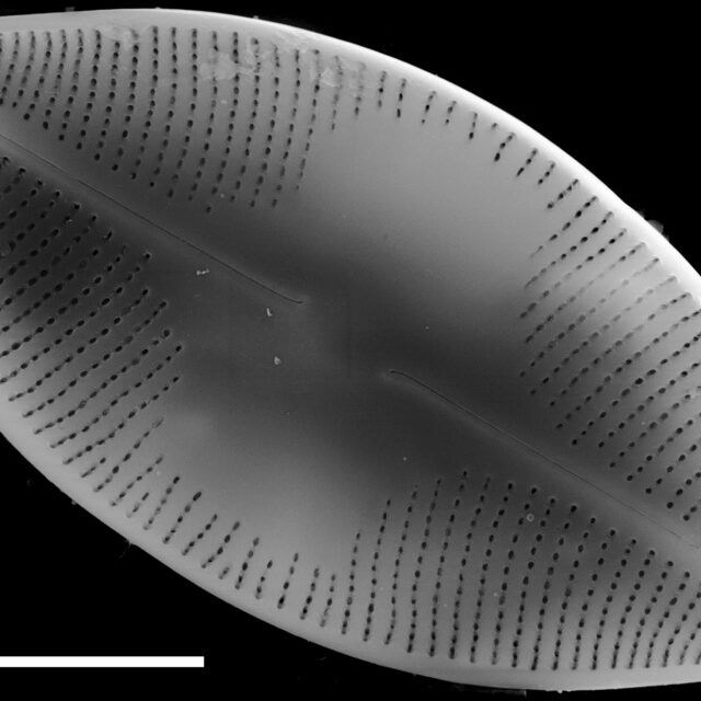 Eucocconeis americana SEM1