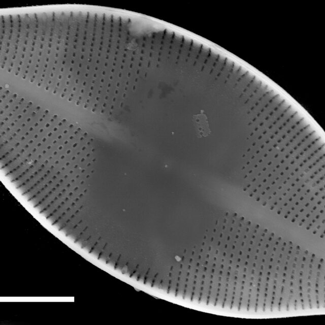 Eucocconeis americana SEM3