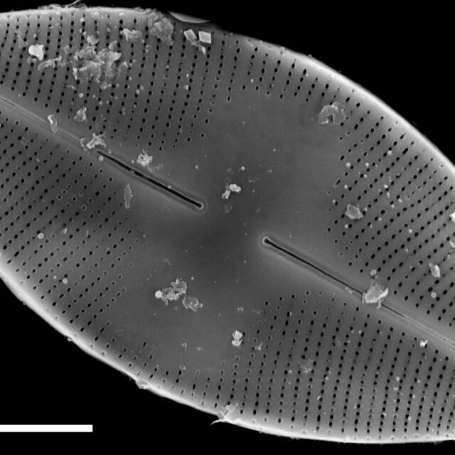 Eucocconeis americana SEM4