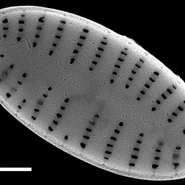 Karayevia oblongella SEM1