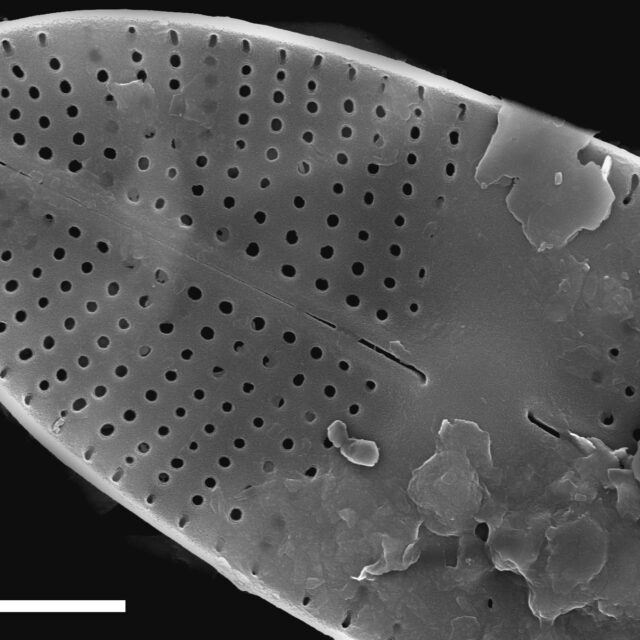 Karayevia oblongella SEM3